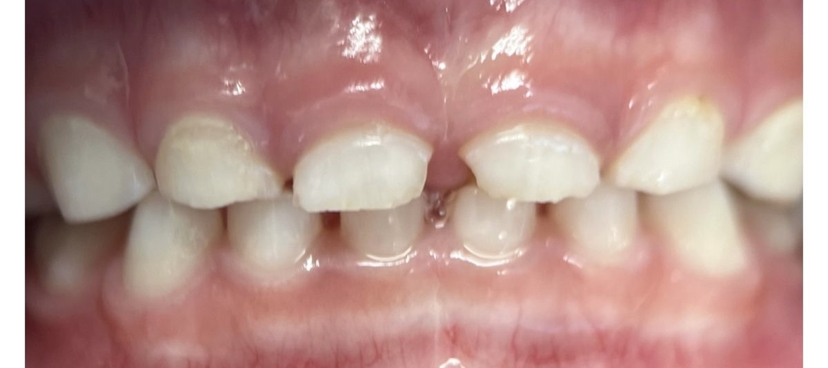 Before image alt