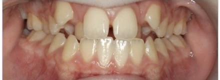 Before image alt