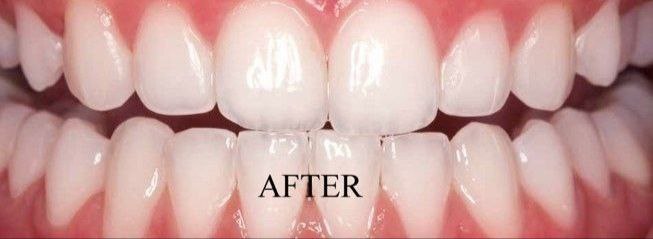 After image alt