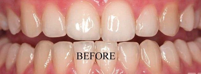 Before image alt
