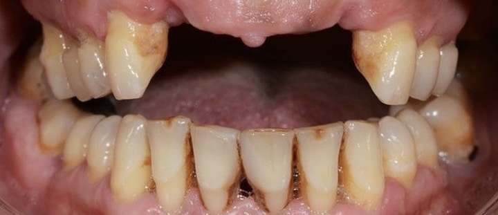 Before image alt